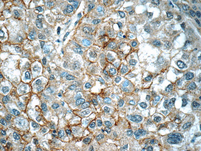 CUL4A Antibody in Immunohistochemistry (Paraffin) (IHC (P))