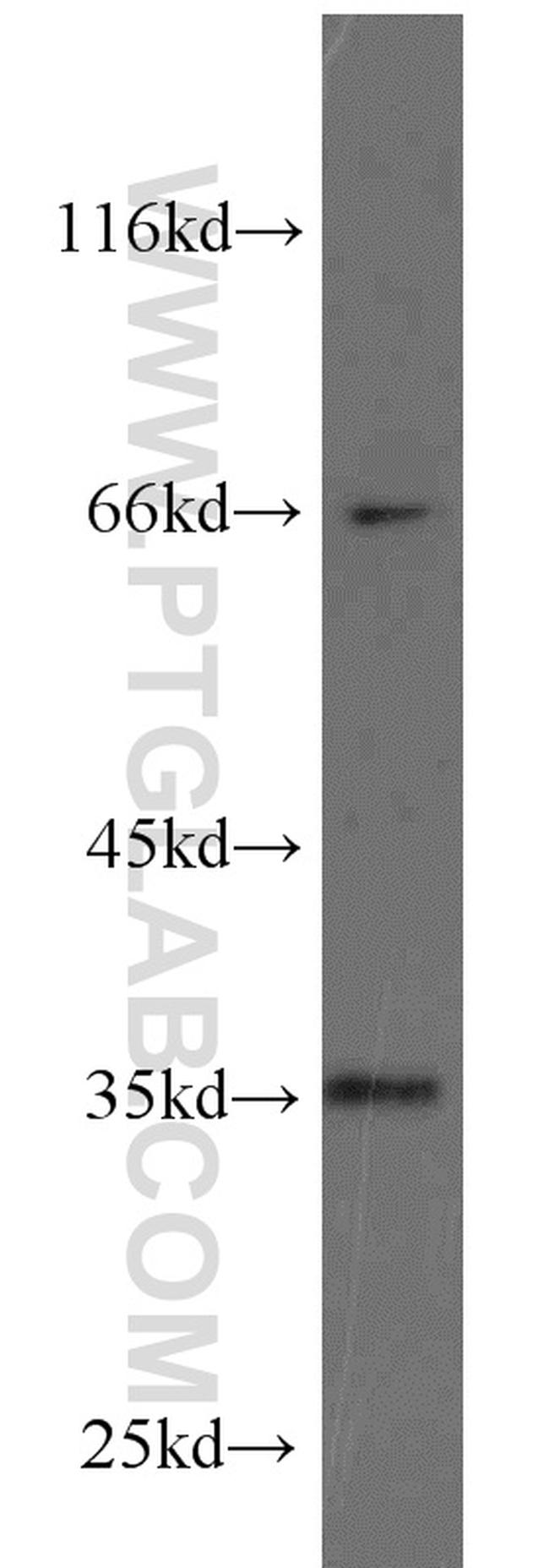 HSD17B7 Antibody in Western Blot (WB)