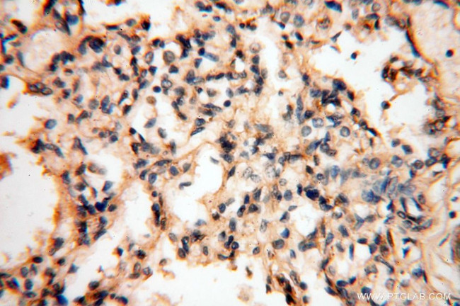 SYK Antibody in Immunohistochemistry (Paraffin) (IHC (P))