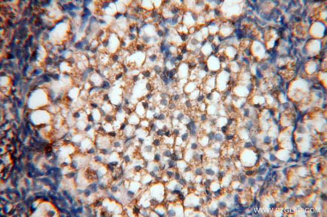 SYK Antibody in Immunohistochemistry (Paraffin) (IHC (P))