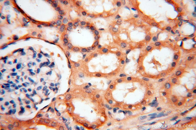 SYK Antibody in Immunohistochemistry (Paraffin) (IHC (P))