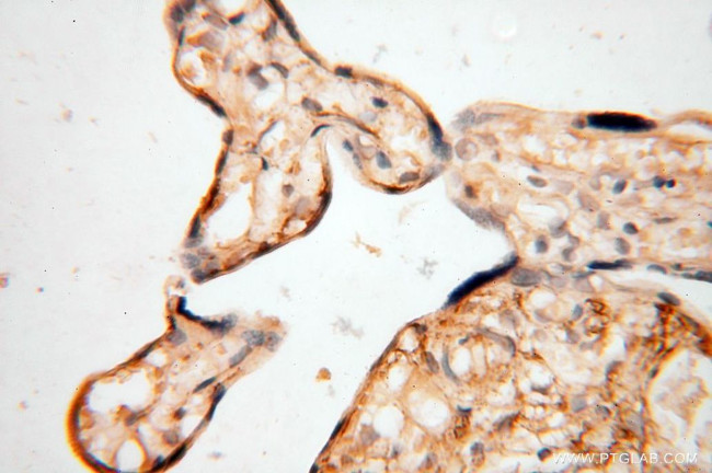 SYK Antibody in Immunohistochemistry (Paraffin) (IHC (P))