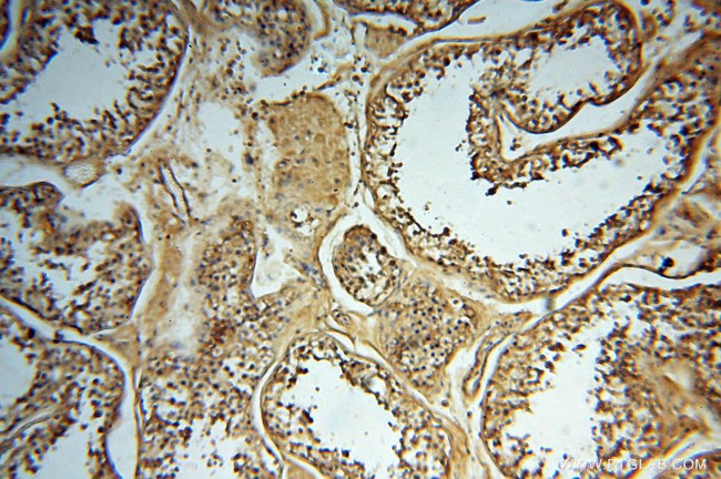 SYK Antibody in Immunohistochemistry (Paraffin) (IHC (P))