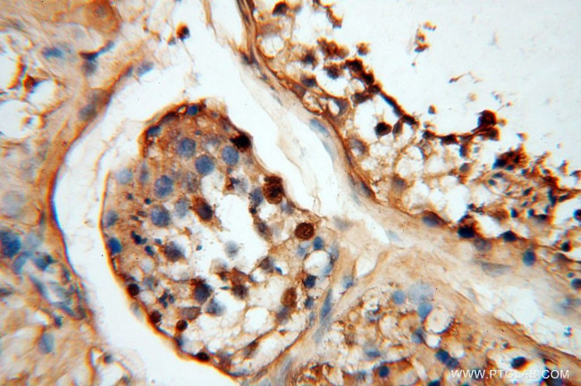 SYK Antibody in Immunohistochemistry (Paraffin) (IHC (P))