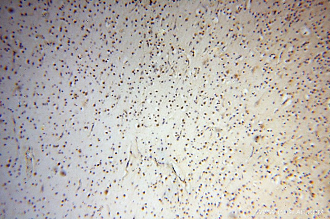 SYK Antibody in Immunohistochemistry (Paraffin) (IHC (P))