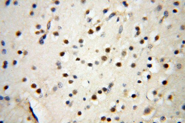 SYK Antibody in Immunohistochemistry (Paraffin) (IHC (P))