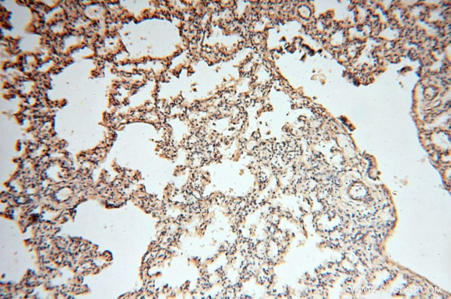 SYK Antibody in Immunohistochemistry (Paraffin) (IHC (P))