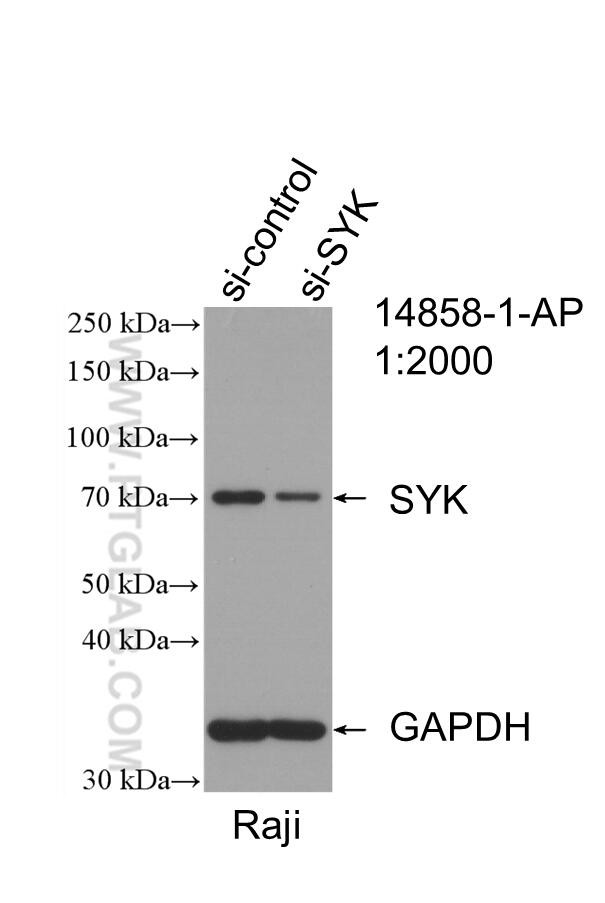 SYK Antibody in Western Blot (WB)