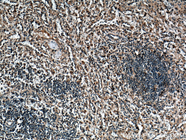 SYK Antibody in Immunohistochemistry (Paraffin) (IHC (P))