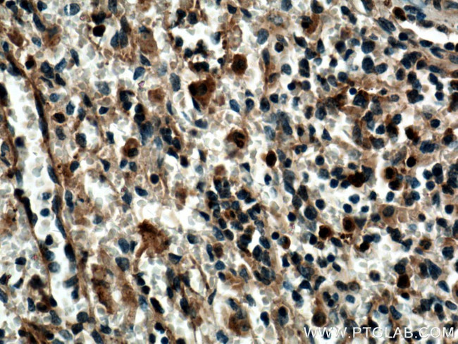 SYK Antibody in Immunohistochemistry (Paraffin) (IHC (P))