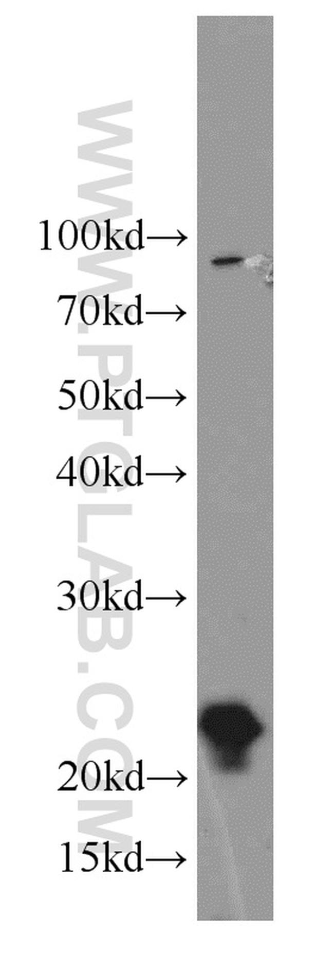 LMP7 Antibody in Western Blot (WB)