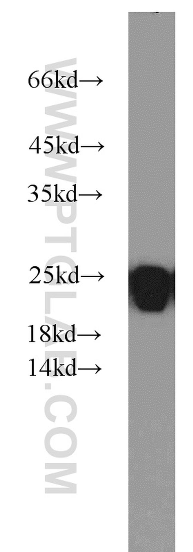 LMP7 Antibody in Western Blot (WB)