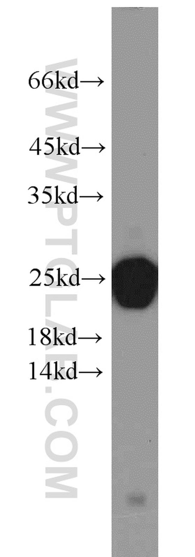 LMP7 Antibody in Western Blot (WB)