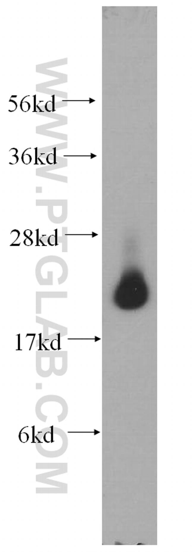 LMP7 Antibody in Western Blot (WB)