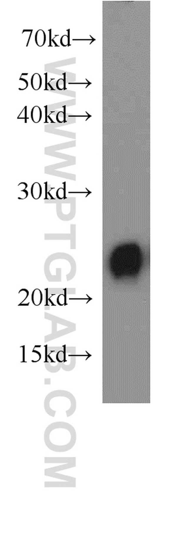 LMP7 Antibody in Western Blot (WB)