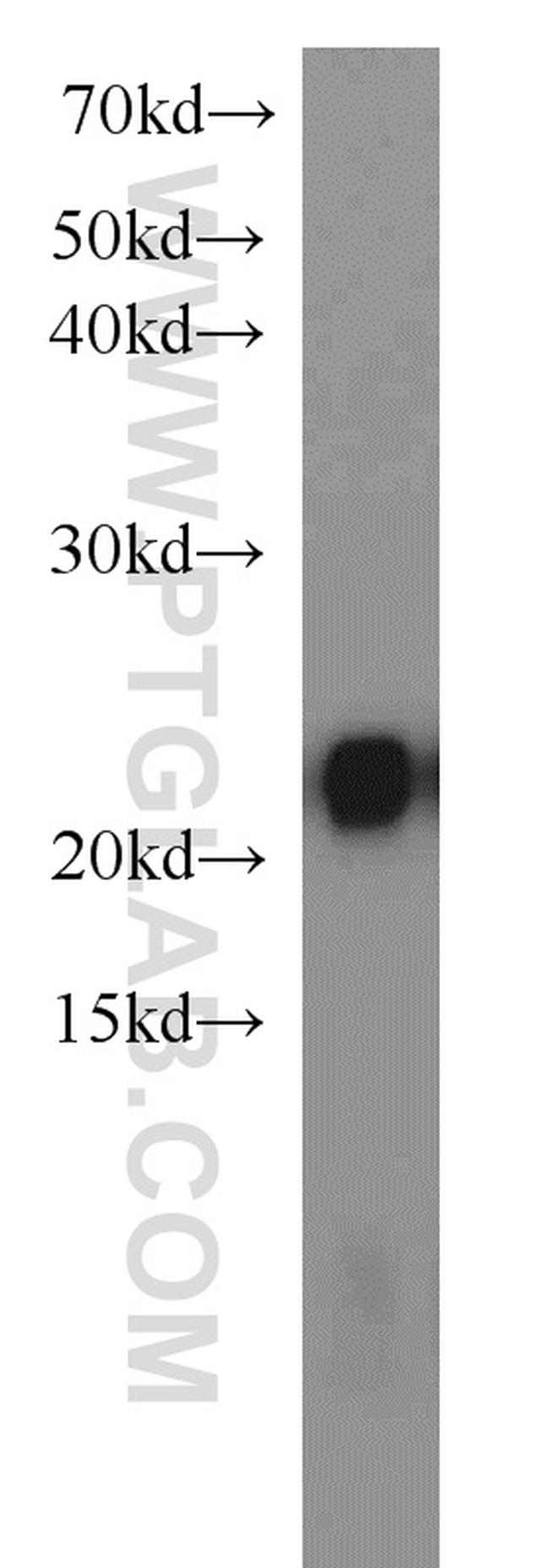 LMP7 Antibody in Western Blot (WB)