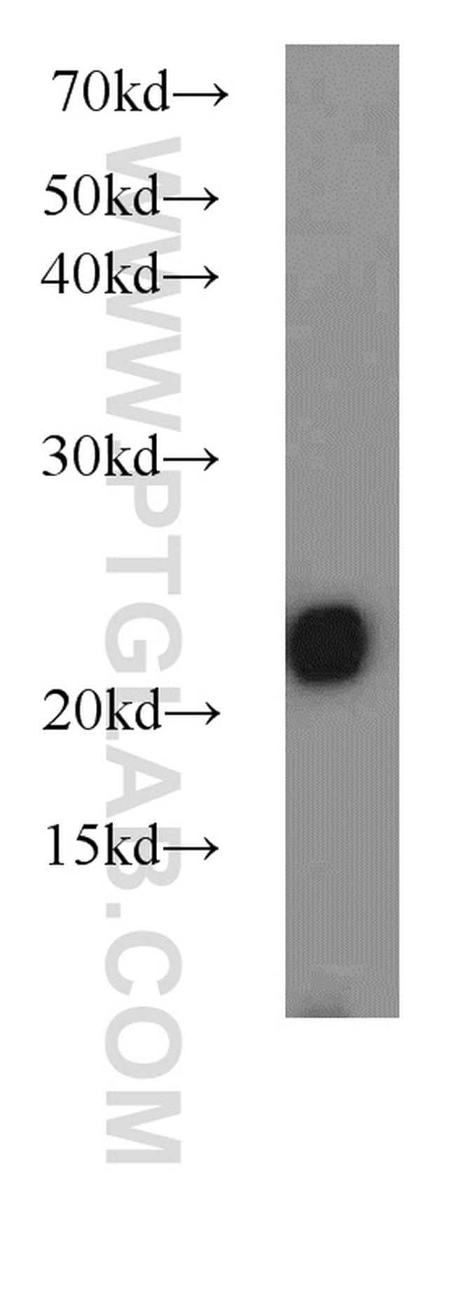 LMP7 Antibody in Western Blot (WB)