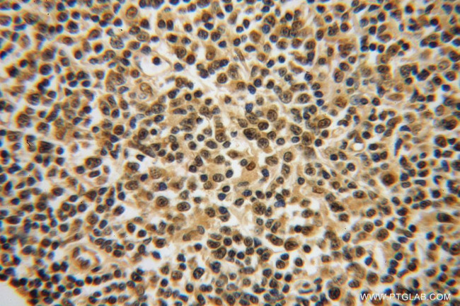 LMP7 Antibody in Immunohistochemistry (Paraffin) (IHC (P))