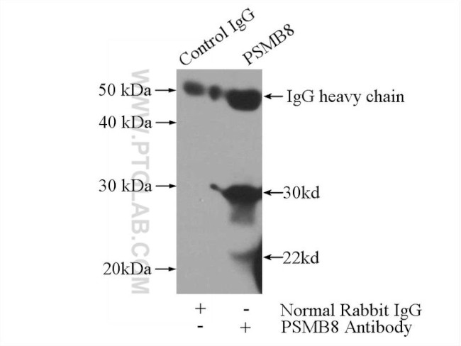 LMP7 Antibody in Immunoprecipitation (IP)