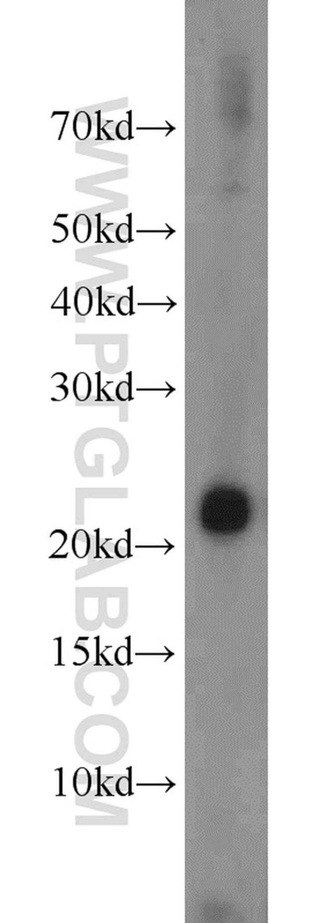 LMP7 Antibody in Western Blot (WB)