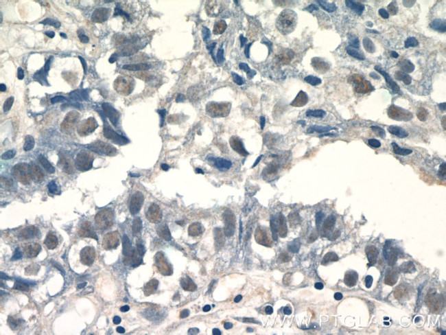 THOC5 Antibody in Immunohistochemistry (Paraffin) (IHC (P))