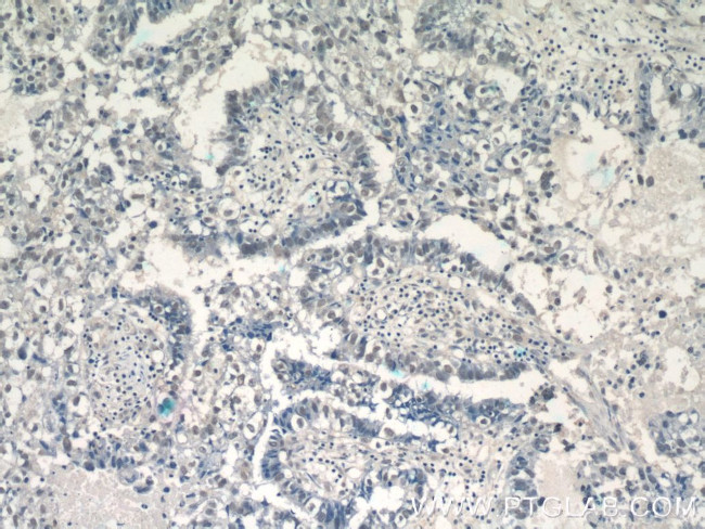 THOC5 Antibody in Immunohistochemistry (Paraffin) (IHC (P))