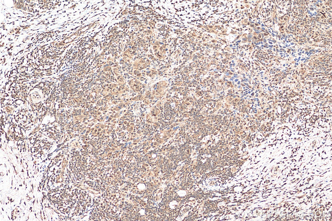 THOC5 Antibody in Immunohistochemistry (Paraffin) (IHC (P))