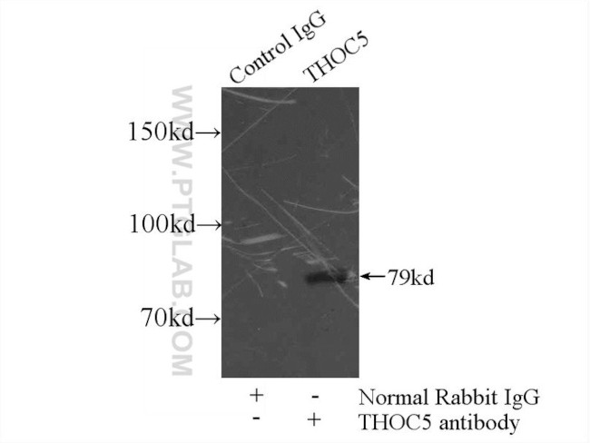 THOC5 Antibody in Immunoprecipitation (IP)