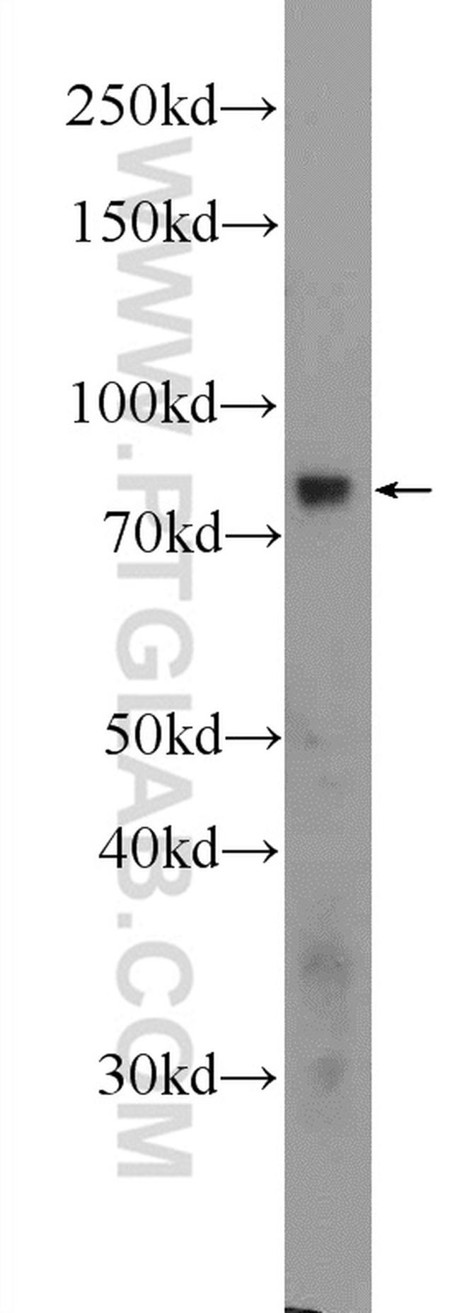 THOC5 Antibody in Western Blot (WB)