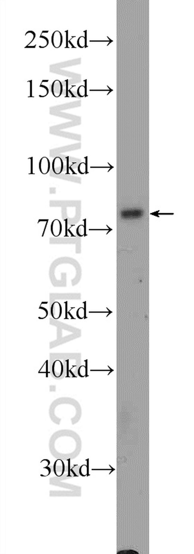 THOC5 Antibody in Western Blot (WB)