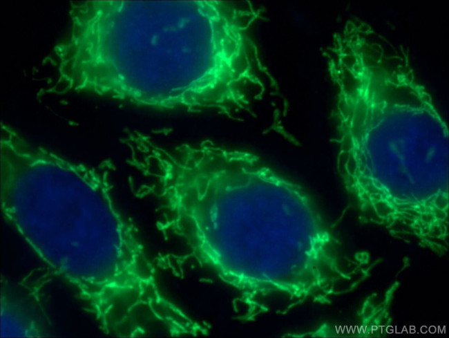 SDHA Antibody in Immunocytochemistry (ICC/IF)