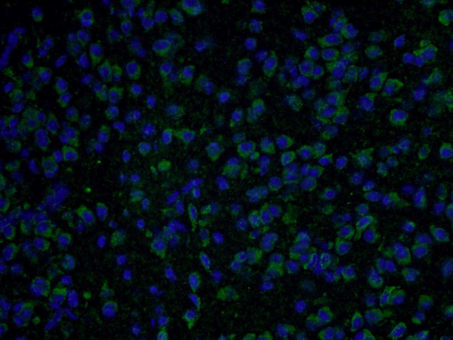 SDHA Antibody in Immunohistochemistry (PFA fixed) (IHC (PFA))