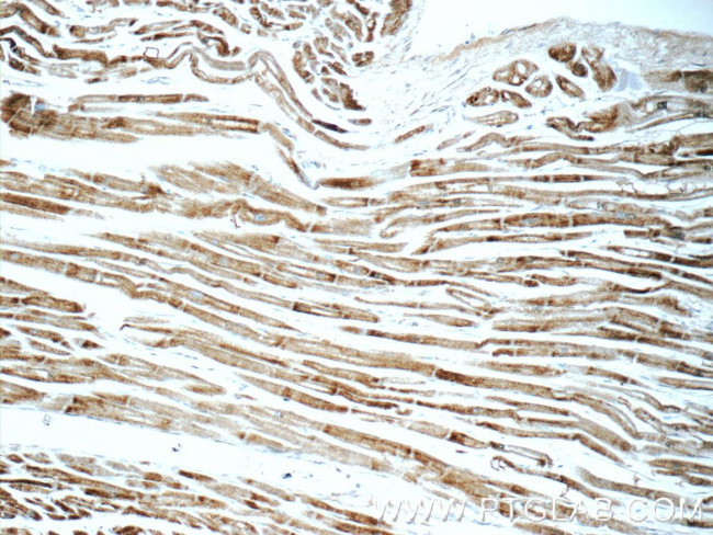 SDHA Antibody in Immunohistochemistry (Paraffin) (IHC (P))