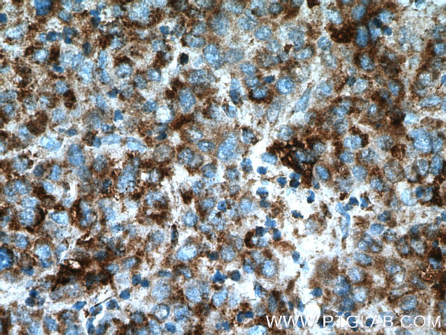 SDHA Antibody in Immunohistochemistry (Paraffin) (IHC (P))