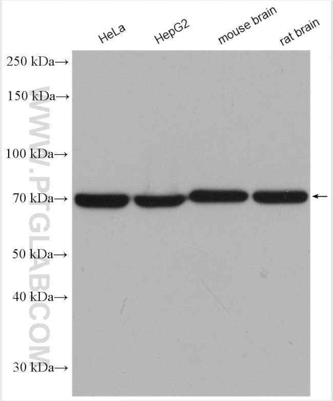 SDHA Antibody in Western Blot (WB)