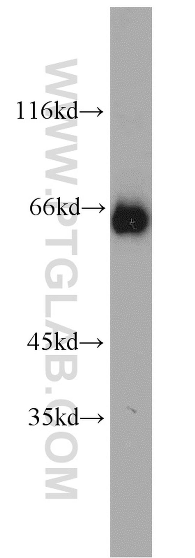 SDHA Antibody in Western Blot (WB)