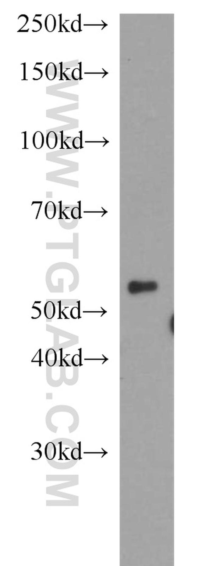 DPH2 Antibody in Western Blot (WB)