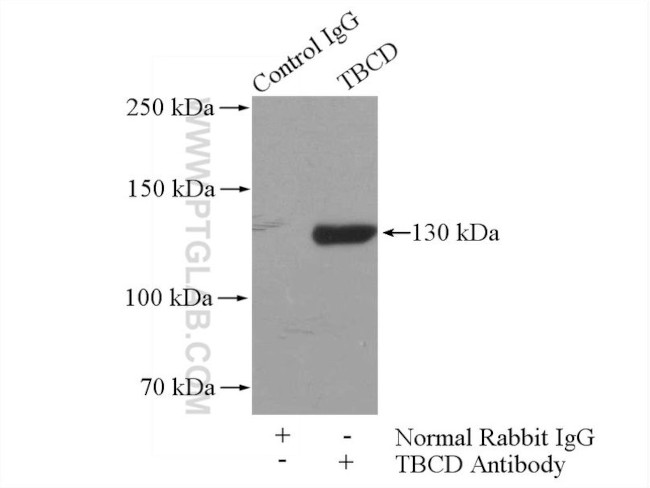TBCD Antibody in Immunoprecipitation (IP)