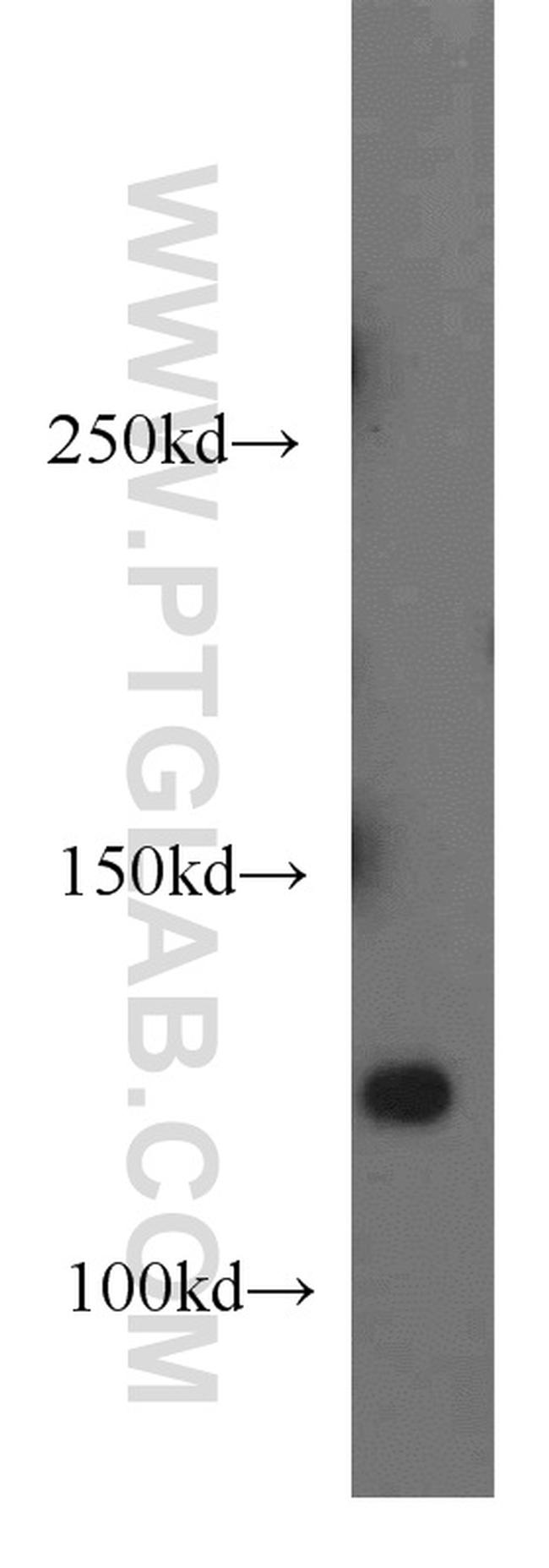 TBCD Antibody in Western Blot (WB)