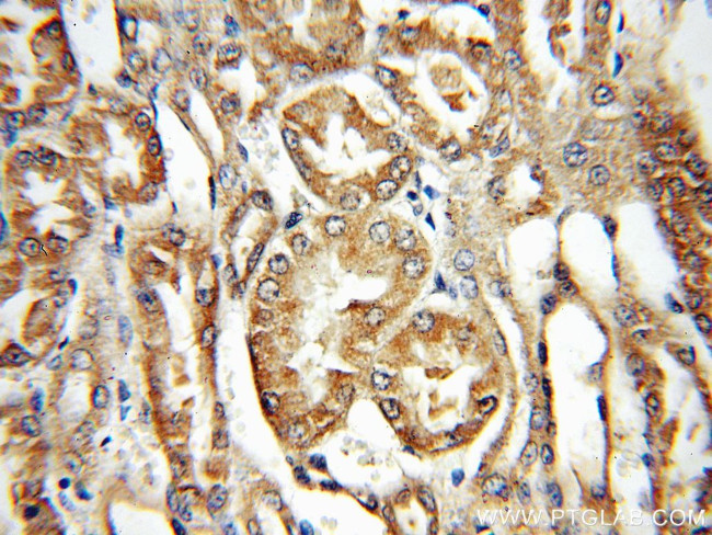 PPOX Antibody in Immunohistochemistry (Paraffin) (IHC (P))