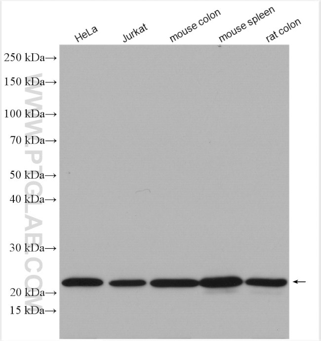 SPCS2 Antibody in Western Blot (WB)