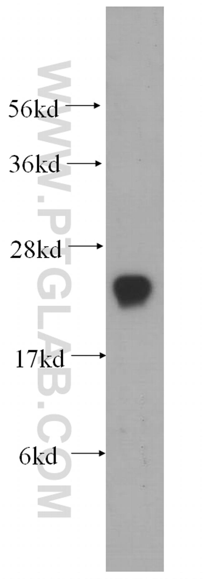 SPCS2 Antibody in Western Blot (WB)