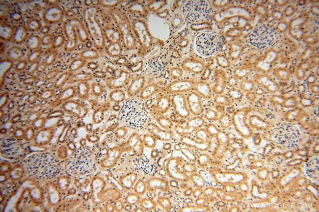 POLM Antibody in Immunohistochemistry (Paraffin) (IHC (P))