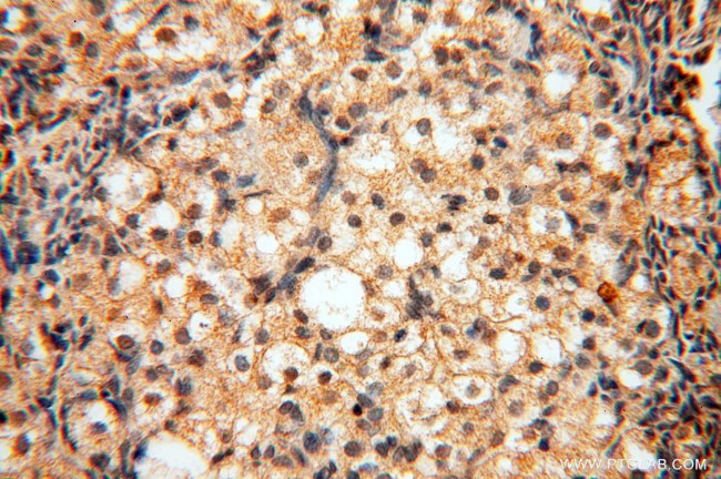 POLM Antibody in Immunohistochemistry (Paraffin) (IHC (P))