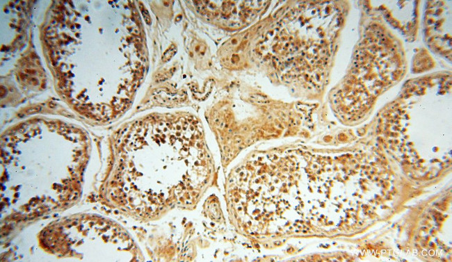 POLM Antibody in Immunohistochemistry (Paraffin) (IHC (P))