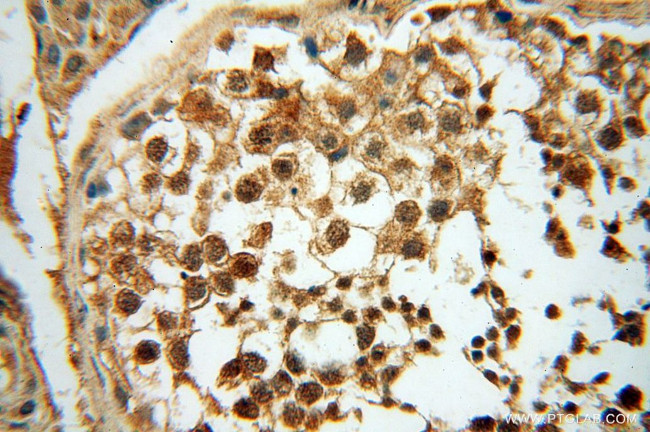 POLM Antibody in Immunohistochemistry (Paraffin) (IHC (P))