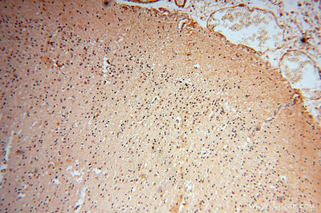 POLM Antibody in Immunohistochemistry (Paraffin) (IHC (P))