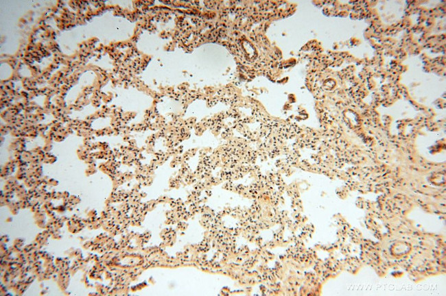 POLM Antibody in Immunohistochemistry (Paraffin) (IHC (P))