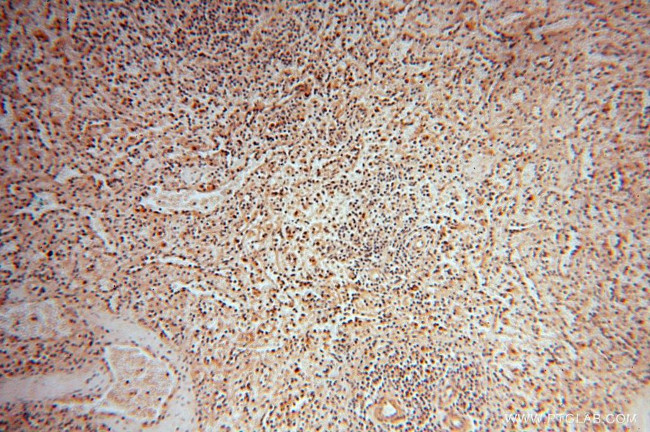 POLM Antibody in Immunohistochemistry (Paraffin) (IHC (P))