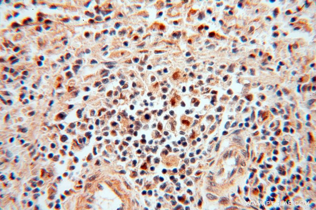 POLM Antibody in Immunohistochemistry (Paraffin) (IHC (P))